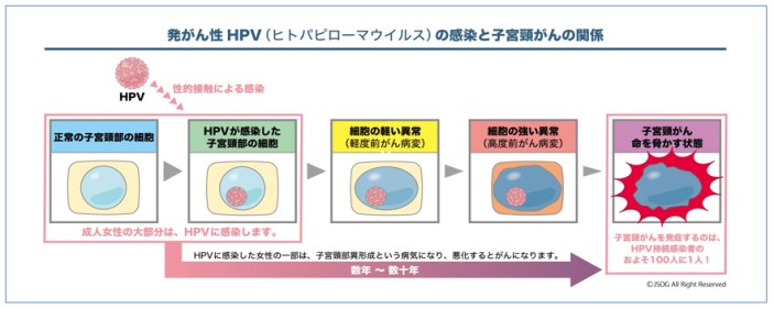 出典：日本産科婦人科学会HP　Part 1 子宮頸がんと HPV ワクチンに関する最新の知識