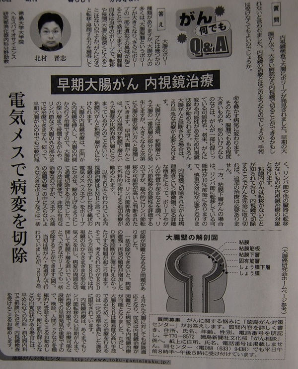徳島新聞｢がん何でもQ&A｣に掲載されました。