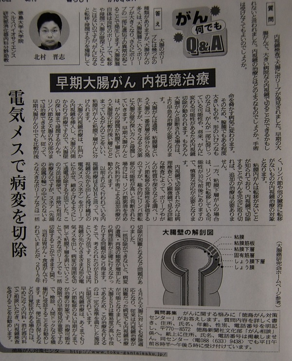 徳島新聞｢がん何でもQ&A｣に掲載されました。